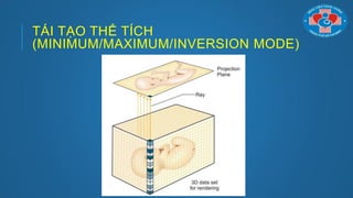 TÁI TẠO THỂ TÍCH
(MINIMUM/MAXIMUM/INVERSION MODE)
 