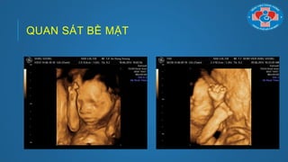 QUAN SÁT BỀ MẶT
 