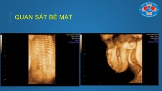 QUAN SÁT BỀ MẶT
 