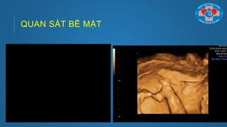 QUAN SÁT BỀ MẶT
 