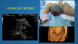 QUAN SÁT BỀ MẶT
 