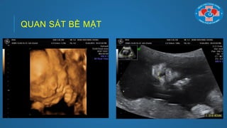 QUAN SÁT BỀ MẶT
 