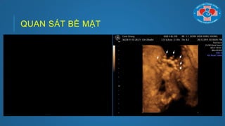 QUAN SÁT BỀ MẶT
 