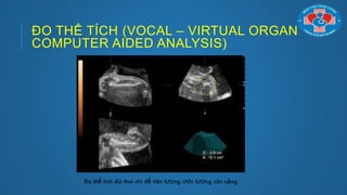 ĐO THỂ TÍCH (VOCAL – VIRTUAL ORGAN
COMPUTER AIDED ANALYSIS)
Đo thể tích đùi thai nhi để tiên lƣợng ƣớc lƣợng cân nặng
 