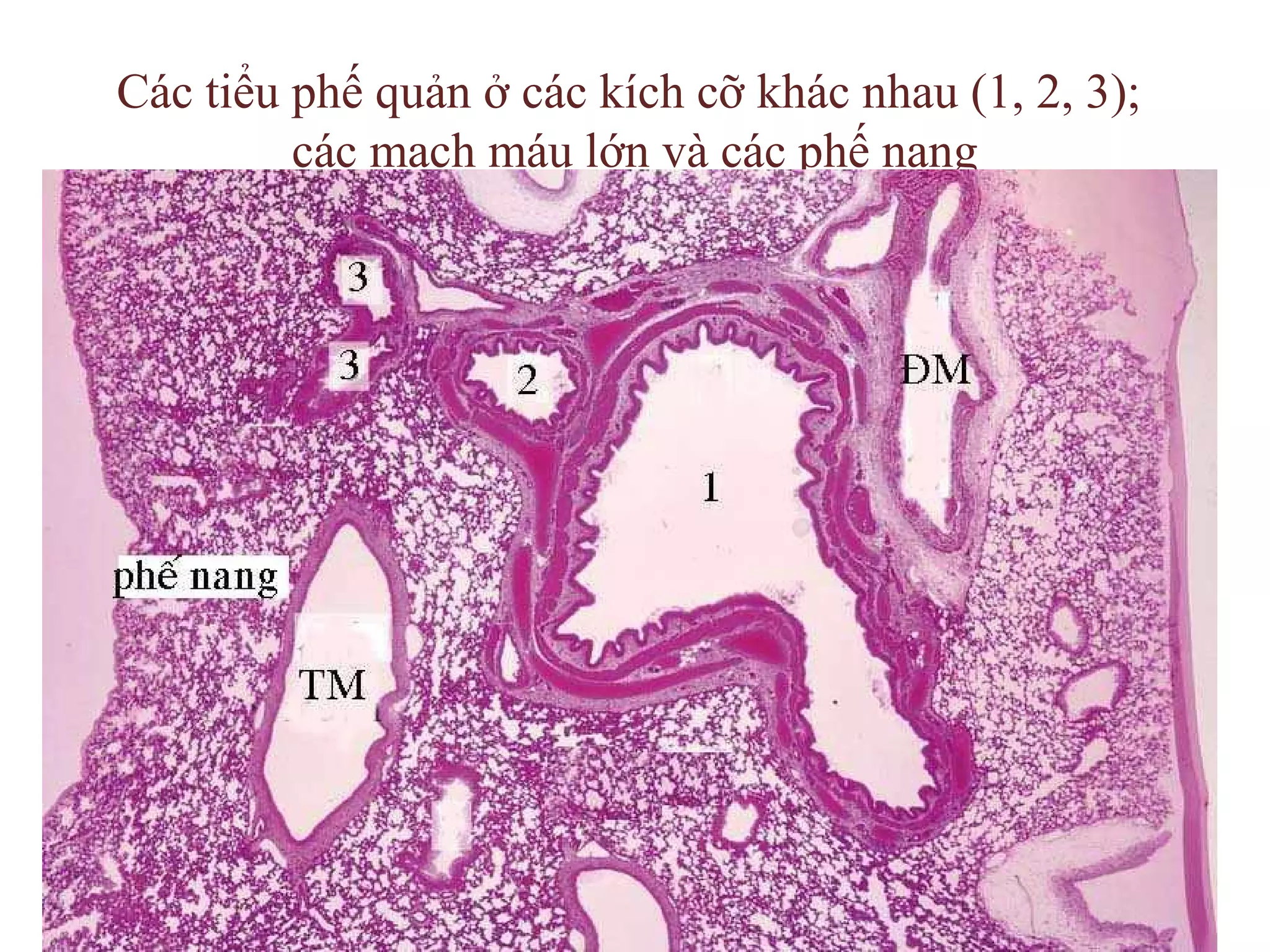 Các tiểu phế quản ở các kích cỡ khác nhau (1, 2, 3);
các mạch máu lớn và các phế nang
 