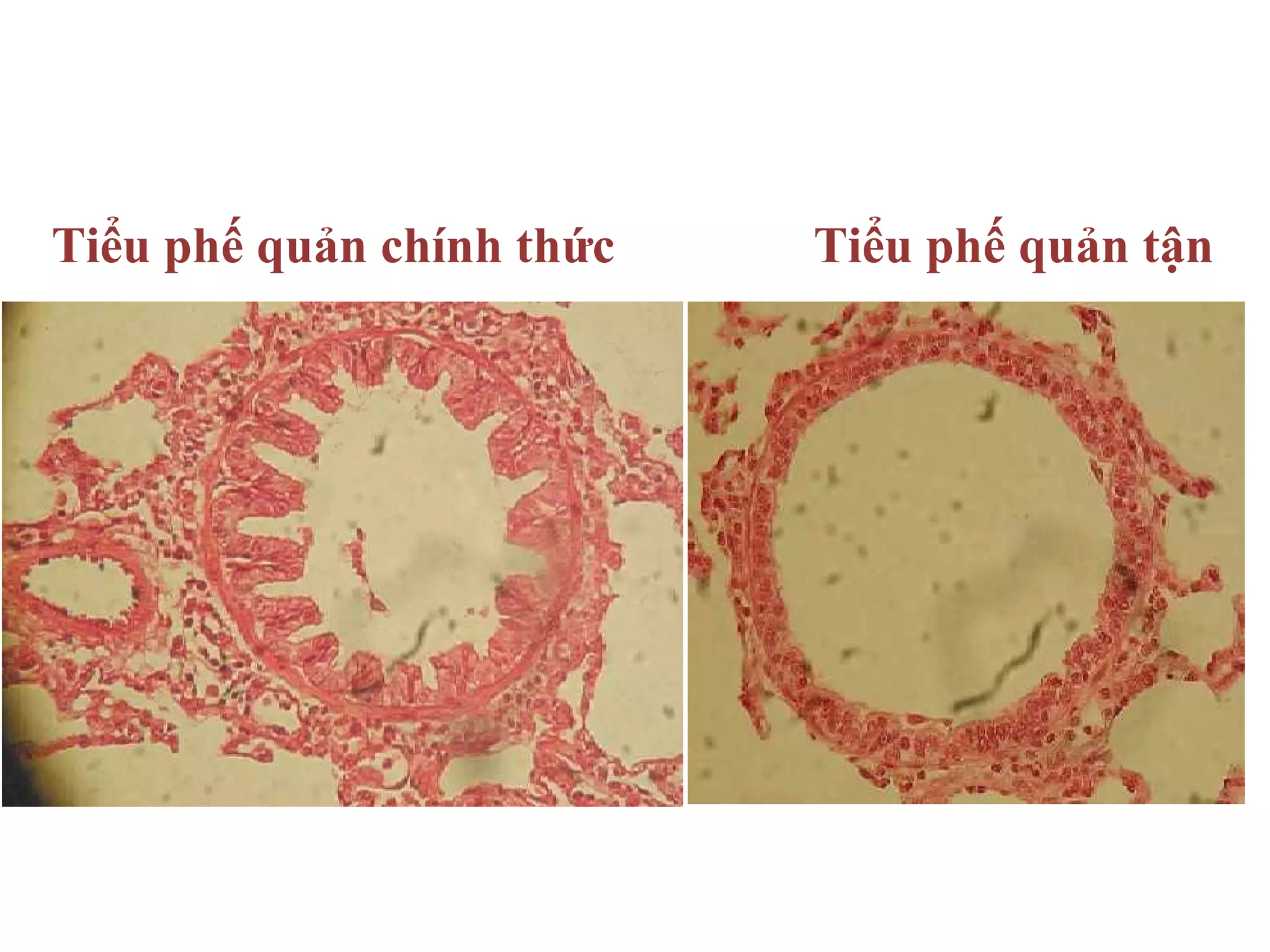 Tiểu phế quản chính thức Tiểu phế quản tận
 