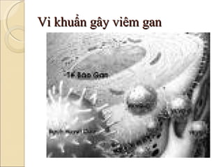 Vi khuẩn gây viêm gan 