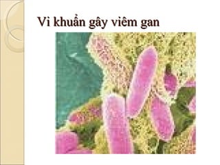 Vi khuẩn gây viêm gan 
