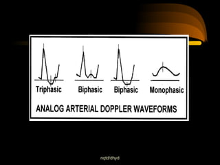 Comprehensive Overview of Doppler Physics and Hemodynamics in Vascular ...