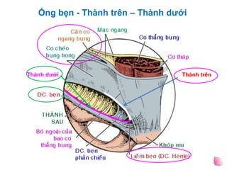 Ống bẹn - Thành trên – Thành dưới
Thành trênThành dưới
 