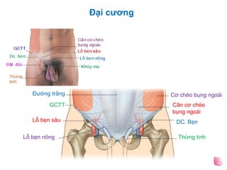Đại cương
Đường trắng
GCTT
Lỗ bẹn sâu
Lỗ bẹn nông
Cơ chéo bụng ngoài
Cân cơ chéo
bụng ngoài
DC. Bẹn
Thừng tinh
 