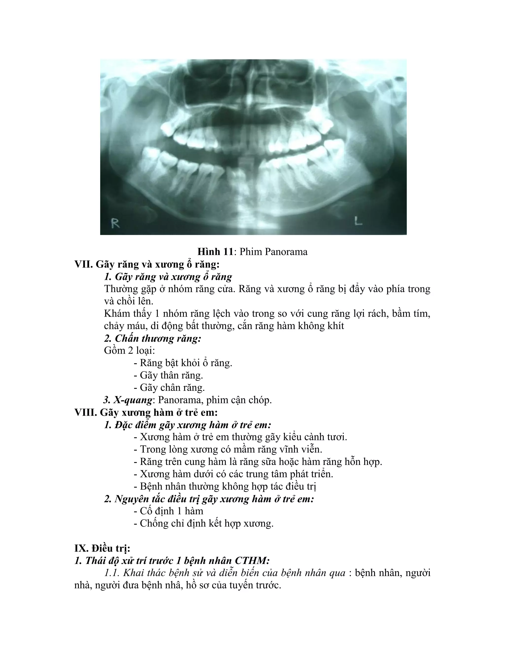 Bai giang rang ham mat | PDF