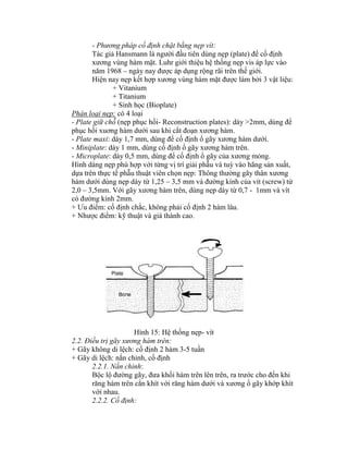 - Phương pháp cố định chặt bằng nẹp vít:
Tác giả Hansmann là người đầu tiên dùng nẹp (plate) để cố định
xương vùng hàm mặt. Luhr giới thiệu hệ thống nẹp vis áp lực vào
năm 1968 – ngày nay được áp dụng rộng rãi trên thế giới.
Hiện nay nẹp kết hợp xương vùng hàm mặt được làm bởi 3 vật liệu:
+ Vitanium
+ Titanium
+ Sinh học (Bioplate)
Phân loại nẹp: có 4 loại
- Plate giữ chỗ (nẹp phục hồi- Reconstruction plates): dày >2mm, dùng để
phục hồi xuơng hàm dưới sau khi cắt đoạn xương hàm.
- Plate maxi: dày 1,7 mm, dùng để cố định ổ gãy xương hàm dưới.
- Miniplate: dày 1 mm, dùng cố định ổ gãy xương hàm trên.
- Microplate: dày 0,5 mm, dùng để cố định ổ gãy của xương mỏng.
Hính dáng nẹp phù hợp với từng vị trì giải phẫu và tuỳ vào hãng sản xuất,
dựa trên thực tế phẫu thuật viên chọn nẹp: Thông thường gãy thân xương
hàm dưới dùng nẹp dày từ 1,25 – 3,5 mm và đường kình của vìt (screw) từ
2,0 – 3,5mm. Với gãy xương hàm trên, dùng nẹp dày từ 0,7 - 1mm và vít
có đường kình 2mm.
+ Ưu điểm: cố định chắc, không phải cố định 2 hàm lâu.
+ Nhược điểm: kỹ thuật và giá thành cao.
Hình 15: Hệ thống nẹp- vít
2.2. Điều trị gãy xương hàm trên:
+ Gãy không di lệch: cố định 2 hàm 3-5 tuần
+ Gãy di lệch: nắn chỉnh, cố định
2.2.1. Nắn chỉnh:
Bộc lộ đường gãy, đưa khối hàm trên lên trên, ra trước cho đến khi
răng hàm trên cắn khìt với răng hàm dưới và xương ổ gãy khớp khìt
với nhau.
2.2.2. Cố định:
 