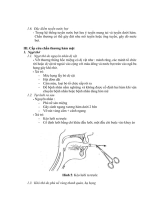 1.6. Đặc điểm tuyến nước bọt
- Trong hệ thống tuyến nước bọt lưu ý tuyến mang tai và tuyến dưới hàm.
Chấn thương có thể gây đứt nhu mô tuyến hoặc ống tuyến, gây dò nước
bọt.
III. Cấp cứu chấn thƣơng hàm mặt
1. Ngạt thở
1.1. Ngạt thở do nguyên nhân dị vật
- Vết thương thông hốc miệng có dị vật như : mảnh răng, các mảnh tổ chức
rời hoặc dị vật từ ngoài vào cộng với máu đông và nước bọt tràn vào ngã ba
họng gây khó thở.
- Xử trì:
- Móc họng lấy bỏ dị vật
- Hút đờm dãi
- Cầm máu, loại bỏ tổ chức sắp rời ra
- Để bệnh nhân nằm nghiêng và không được cố định hai hàm khi vận
chuyển bệnh nhân hoặc bệnh nhân đang hôn mê
1.2. Tụt lưỡi ra sau
- Nguyên nhân :
- Phù nề sàn miệng
- Gãy cành ngang xương hàm dưới 2 bên
- Vỡ nát vùng cằm + cành ngang
- Xử trì:
- Kéo lưỡi ra trước
- Cố định lưỡi bằng chỉ khâu đầu lưỡi, một đầu chỉ buộc vào khuy áo
Hình 5: Kéo lưỡi ra trước
1.3. Khó thở do phù nề vùng thanh quản, hạ họng
 