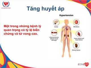 Tăng huyết áp
Một trong những bệnh lý
quan trọng có tỷ lệ biến
chứng và tử vong cao.
2
 