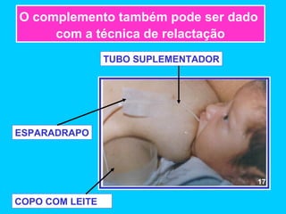O complemento também pode ser dado
     com a técnica de relactação
                 TUBO SUPLEMENTADOR




ESPARADRAPO




                                      17

COPO COM LEITE
 