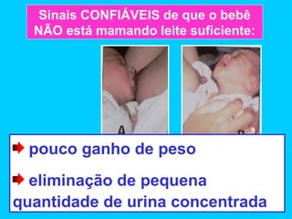 Sinais CONFIÁVEIS de que o bebê
  NÃO está mamando leite suficiente:




                                   9

 pouco ganho de peso
  eliminação de pequena
quantidade de urina concentrada
 