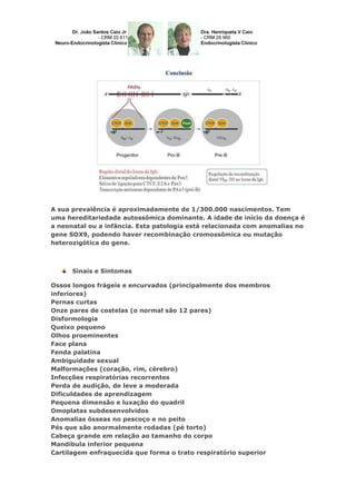 A sua prevalência é aproximadamente de 1/300.000 nascimentos. Tem
uma hereditariedade autossômica dominante. A idade de início da doença é
a neonatal ou a infância. Esta patologia está relacionada com anomalias no
gene SOX9, podendo haver recombinação cromossômica ou mutação
heterozigótica do gene.
Sinais e Sintomas
Ossos longos frágeis e encurvados (principalmente dos membros
inferiores)
Pernas curtas
Onze pares de costelas (o normal são 12 pares)
Disformologia
Queixo pequeno
Olhos proeminentes
Face plana
Fenda palatina
Ambiguidade sexual
Malformações (coração, rim, cérebro)
Infecções respiratórias recorrentes
Perda de audição, de leve a moderada
Dificuldades de aprendizagem
Pequena dimensão e luxação do quadril
Omoplatas subdesenvolvidos
Anomalias ósseas no pescoço e no peito
Pés que são anormalmente rodadas (pé torto)
Cabeça grande em relação ao tamanho do corpo
Mandíbula inferior pequena
Cartilagem enfraquecida que forma o trato respiratório superior
 