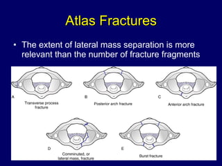 Atlas Fractures The extent of lateral mass separation is more relevant than the number of fracture fragments 