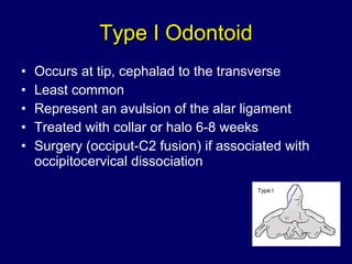 Type I Odontoid Occurs at tip, cephalad to the transverse Least common  Represent an avulsion of the alar ligament Treated with collar or halo 6-8 weeks Surgery (occiput-C2 fusion) if associated with occipitocervical dissociation  