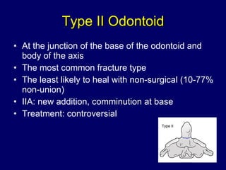 Type II Odontoid At the junction of the base of the odontoid and body of the axis  The most common fracture type The least likely to heal with non-surgical (10-77% non-union) IIA: new addition, comminution at base Treatment: controversial 