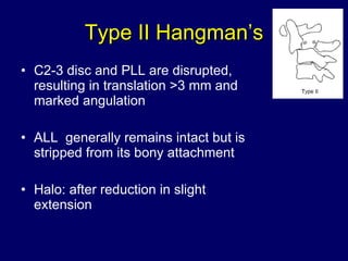 Type II Hangman’s C2-3 disc and PLL are disrupted, resulting in translation >3 mm and marked angulation ALL  generally remains intact but is stripped from its bony attachment Halo: after reduction in slight extension 