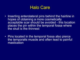 Halo Care Inserting anterolateral pins behind the hairline in hopes of obtaining a more cosmetically acceptable scar should be avoided - this location places the pin within the temporal fossa where the skull is the thinnest Pins located in the temporal fossa also pierce the temporalis muscle and often lead to painful mastication 