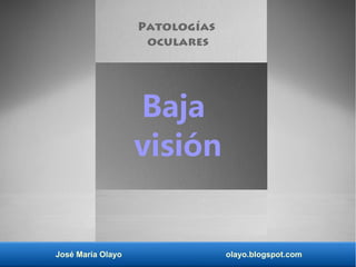 José María Olayo olayo.blogspot.com
Baja
visión
Patologías
oculares
 