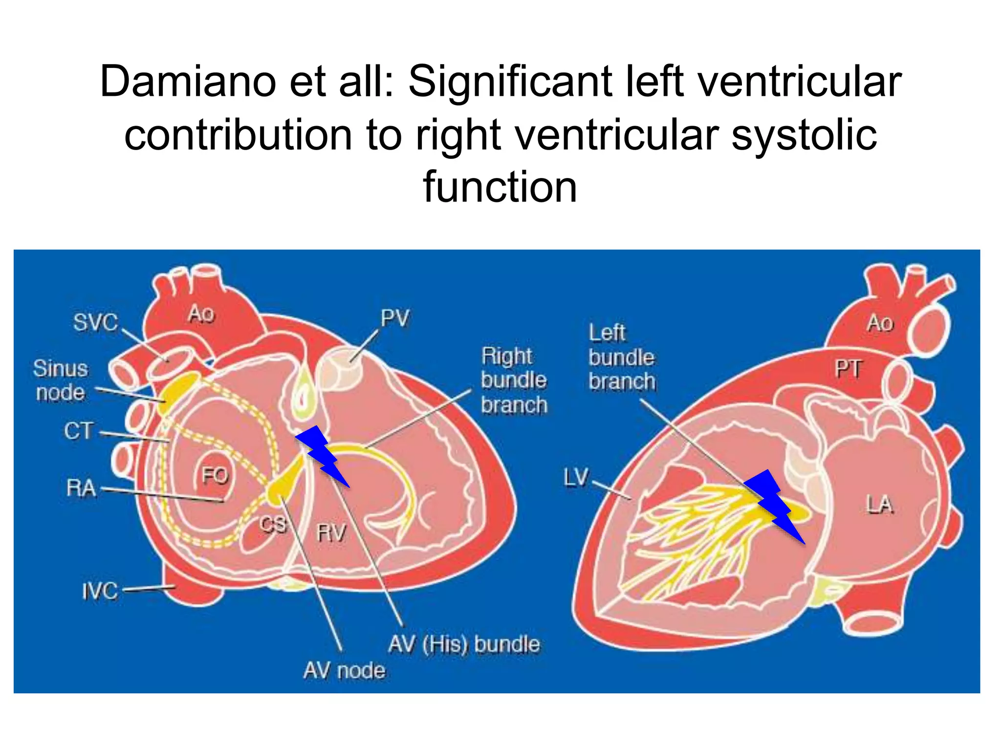Low cardiac output due to acute right ventricular dysfunction in ...