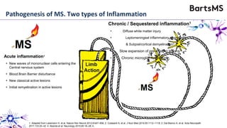 Pathogenesis of MS. Two types of Inflammation
Acute inflammation1
• New waves of mononuclear cells entering the
Central nervous system
• Blood Brain Barrier disturbance
• New classical active lesions
• Initial remyelination in active lesions
Chronic / Sequestered inflammation1
• Diffuse white matter injury
• Leptomeningeal inflammatory aggregates
& Subpial/cortical demyelination2
• Slow expansion of pre-existing lesions3
• Chronic microglial Activation4
1. Adapted from Lassmann H, et al. Nature Rev Neurol 2012;8:647–656; 2. Colasanti A, et al. J Nucl Med 2014;55:1112–1118; 3. Dal-Bianco A, et al. Acta Neuropath
2017;133:25–42 4. Absinta et al. Neurology 2015;85:18–28; 4..
 