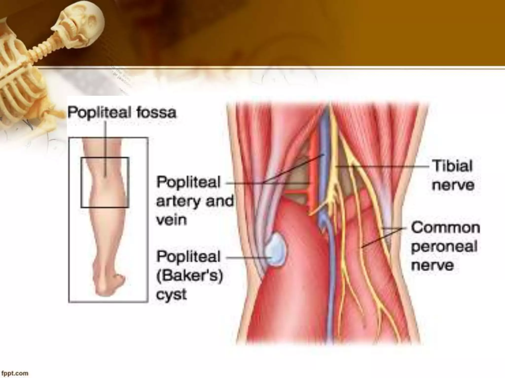 Baker's cyst