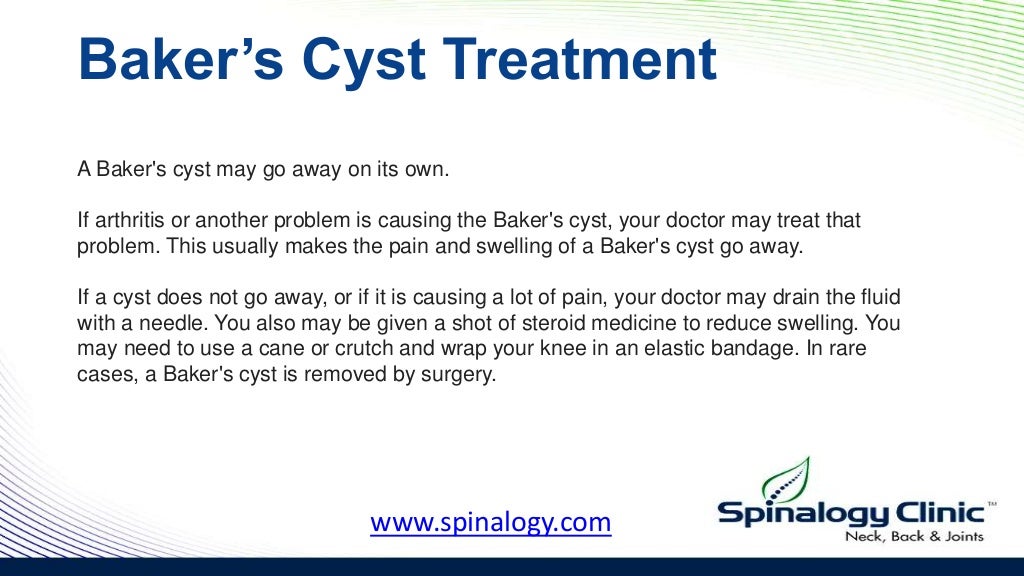 Bakers cyst symptoms, causes, diagnosis, & treatment