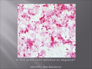 Chapter 4 Is this gram stain positive or negative?  Identify the bacteria. 