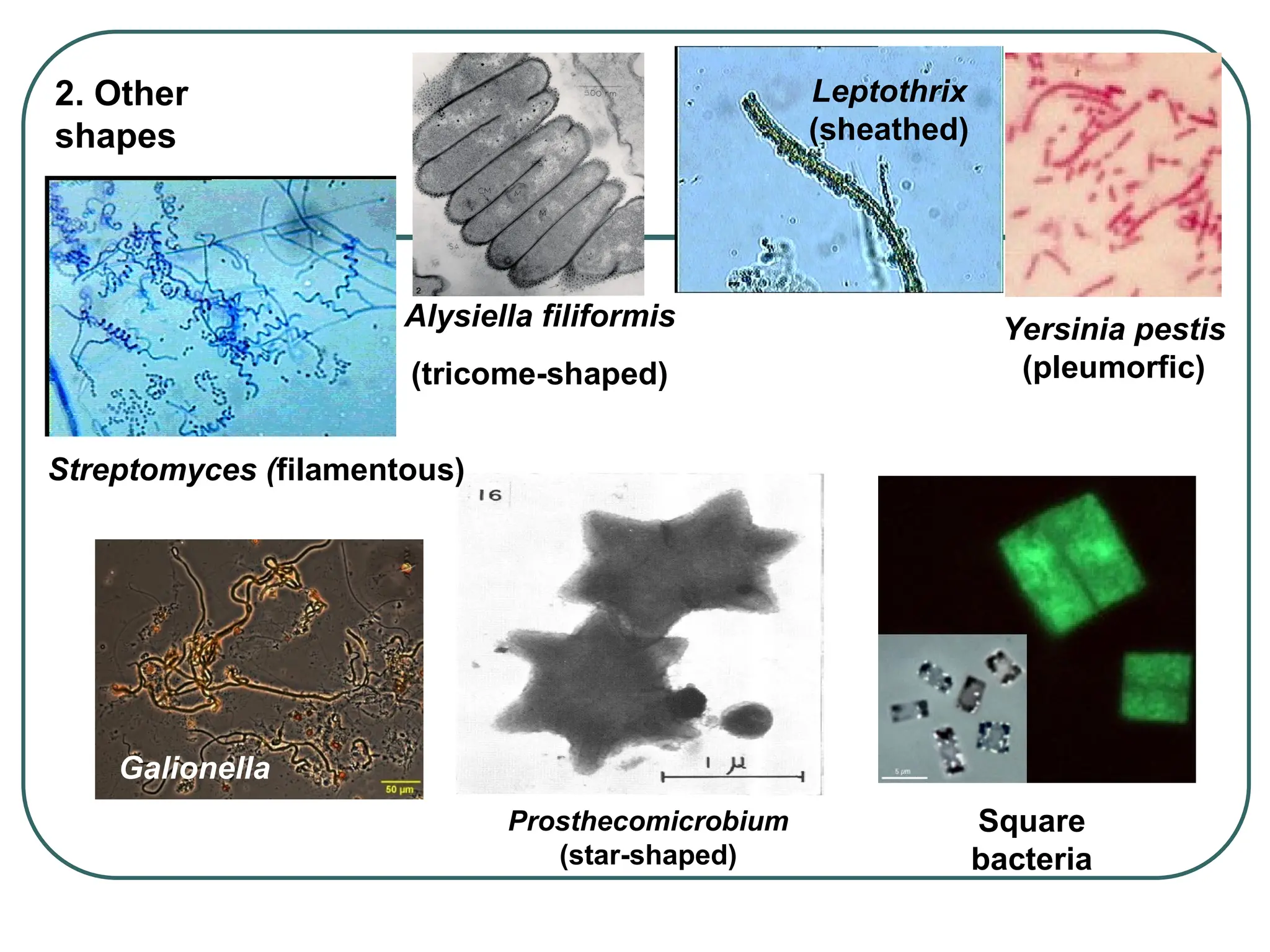 2. Other
shapes
Streptomyces (filamentous)
Leptothrix
(sheathed)
Prosthecomicrobium
(star-shaped)
Yersinia pestis
(pleumorfic)
Alysiella filiformis
(tricome-shaped)
Galionella
Square
bacteria
 