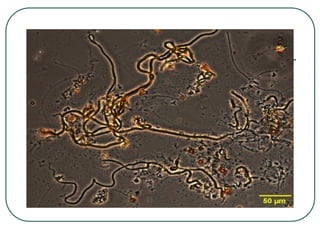 powerpoint kingdom eubacteria dan archaebacteria -3.ppt