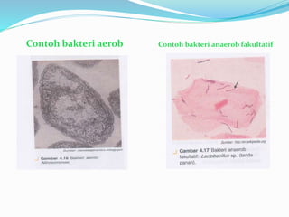 Contoh bakteri aerob Contoh bakteri anaerob fakultatif
 