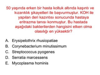 50 yaşında erken bir hasta koltuk altında kaşıntı ve  kızarıklık şikayetleri ile başvurmuştur. KOH ile yapılan deri kazıntısı sonucunda hastaya eritrazma tanısı konmuştur. Bu hastada aşağıdaki bakterilerden hangisini etken olma olasılığı en yüksektir? Erysipelothrix rhusiopatiae Corynebacterium minutissimum Streptococcus pyogenes Serratia marcessens Mycoplasma hominis 