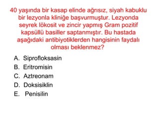 40 yaşında bir kasap elinde ağrısız, siyah kabuklu bir lezyonla kliniğe başvurmuştur. Lezyonda seyrek lökosit ve zincir yapmış Gram pozitif kapsüllü basiller saptanmıştır. Bu hastada aşağıdaki antibiyotiklerden hangisinin faydalı olması beklenmez?   Siprofloksasin Eritromisin C.  Aztreonam D.  Doksisiklin E.  Penisilin 