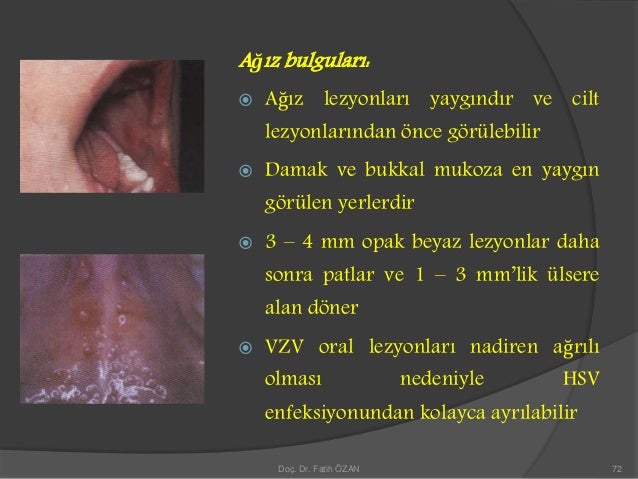 İlaç Reduxin: doktorların incelemeleri 56