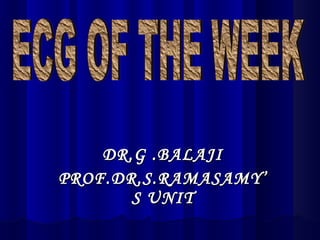 DR.G .BALAJI PROF.DR.S.RAMASAMY’S UNIT ECG OF THE WEEK 