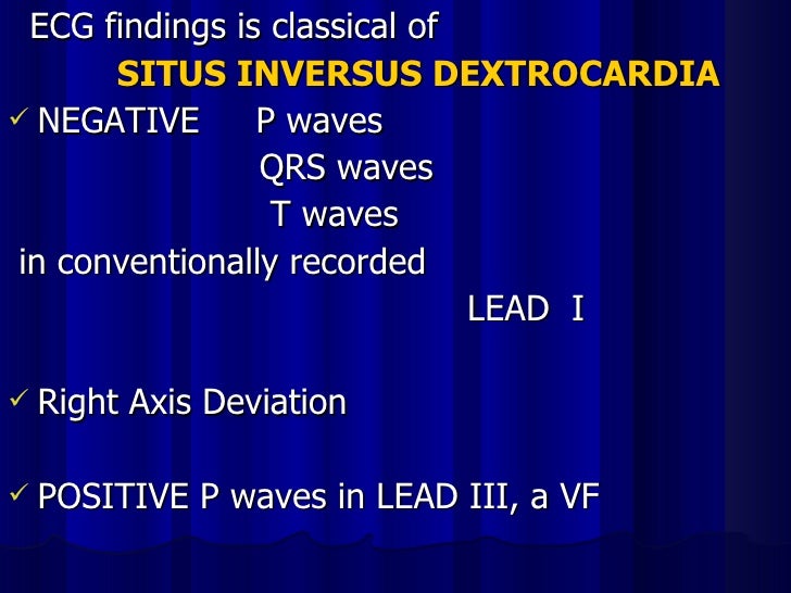 Ecg Cardiac Malpositions Ecg Cardiac Malpositions