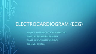 ELECTROCARDIOGRAM (ECG)
SUBJECT: PHARMACEUTICAL MARKETING
NAME: M. BALAMURALIDHARAN
CLASS: III B.SC BIOTECHNOLOGY
ROLL NO: 18UT26
 