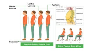 Standing Posture Good & Poor
Sitting Posture Good & Poor
Normal
Posture
Lumbar
Lordosis
Swayback
Kyphosis
 