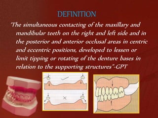 DEFINITION 
‘The simultaneous contacting of the maxillary and 
mandibular teeth on the right and left side and in 
the posterior and anterior occlusal areas in centric 
and eccentric positions, developed to lessen or 
limit tipping or rotating of the denture bases in 
relation to the supporting structures”-GPT 
 