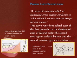Lateral view with 2nd PM 
& 1st molar follow the 
reverse curve 
Pleasure Curve/Reverse Curve 
“A curve of occlusion which in 
transverse cross section conforms to 
a line which is convex upward except 
for last molars” 
This curve runs from palatal cusp of 
the first premolar to the distobucaal 
cusp of second molar,The second 
molar gives occlusal balance and the 
second premolar gives lever balance. 
Reverse curve is 
used in the 
bicuspid area for 
lever balance 
 