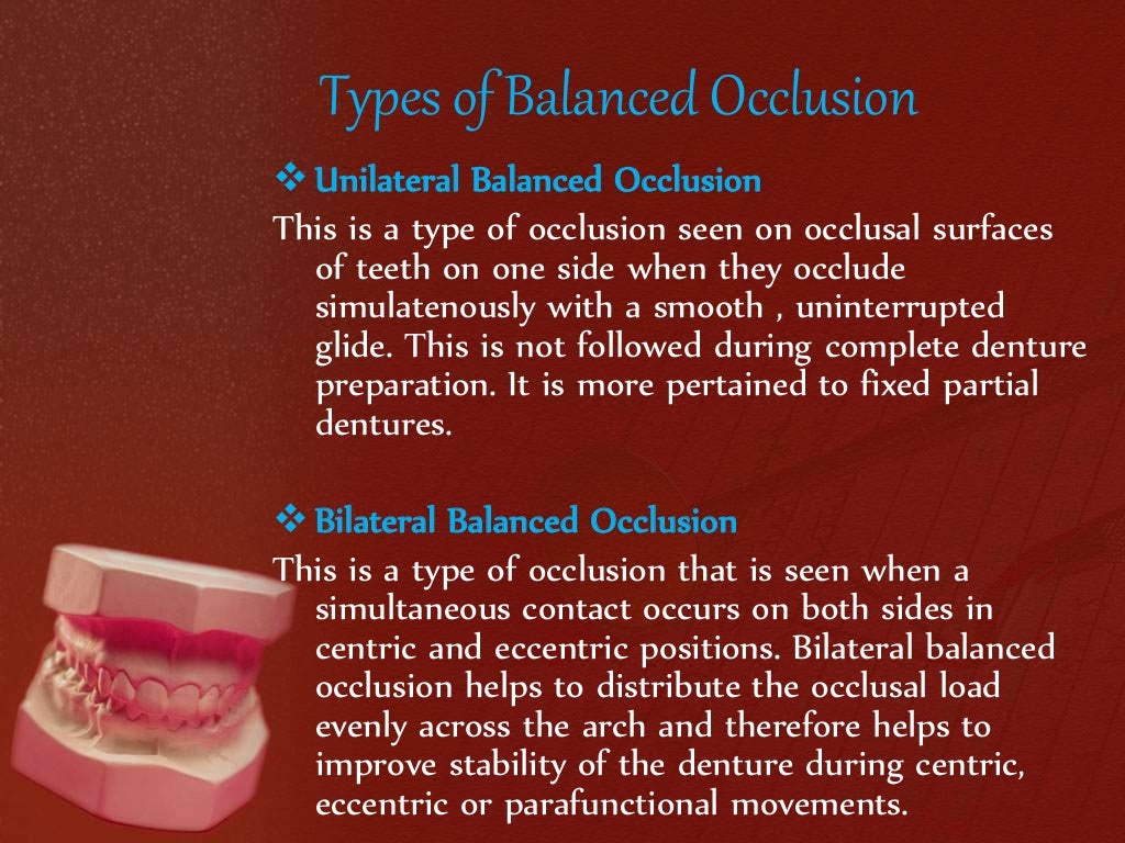 Balanced occlusion Prosthodontics