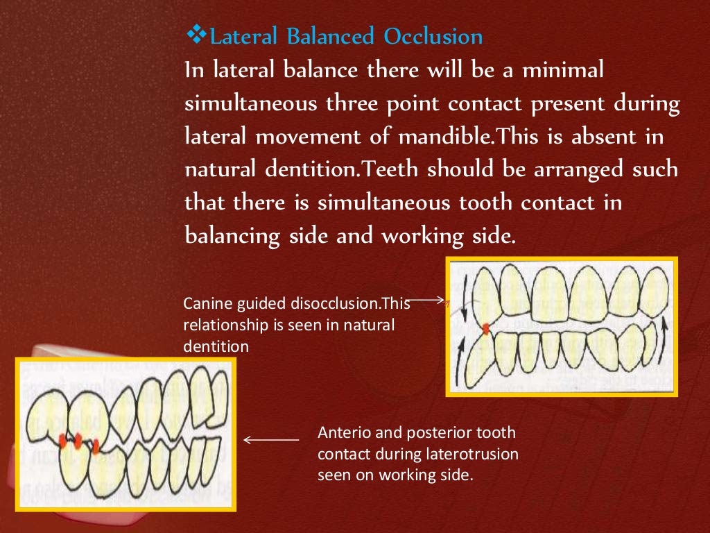 Balanced occlusion Prosthodontics
