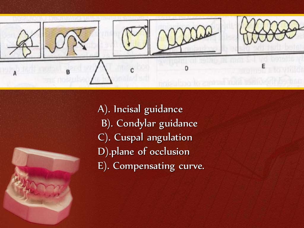Balanced occlusion Prosthodontics