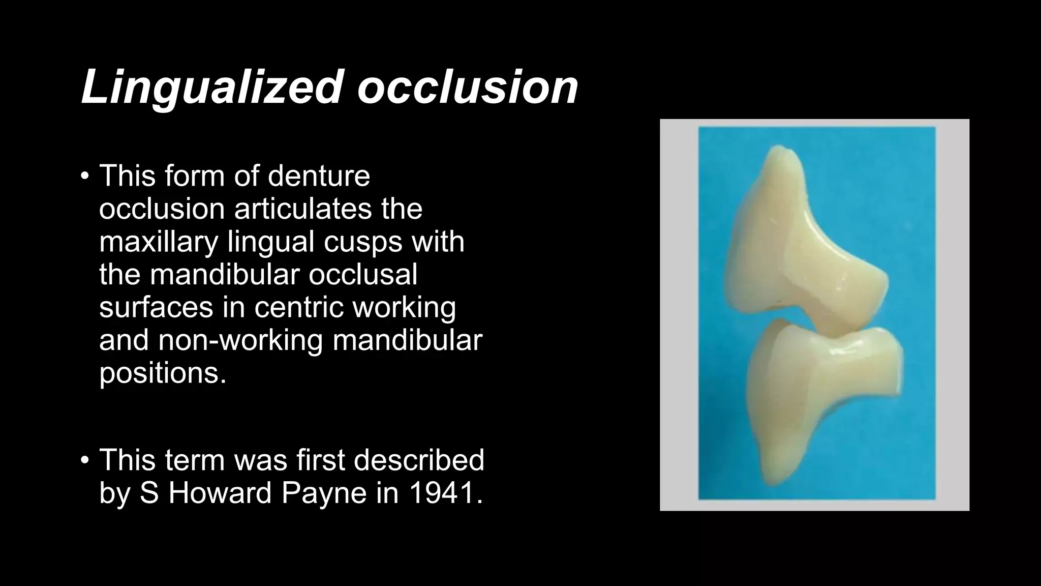 Lingualized occlusion
• This form of denture
occlusion articulates the
maxillary lingual cusps with
the mandibular occlusal
surfaces in centric working
and non-working mandibular
positions.
• This term was first described
by S Howard Payne in 1941.
 