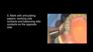 5. Mark with articulating
papers- working side
contacts and balancing side
contacts on the opposite
side
 